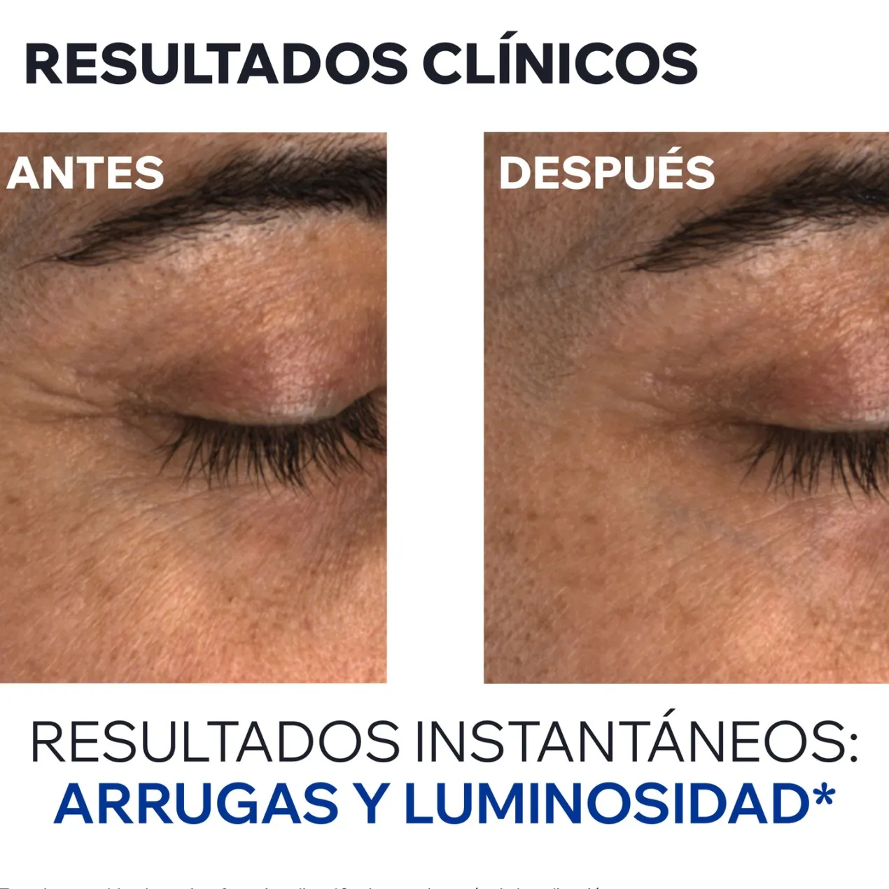 Age Absolu Contorno de Ojos