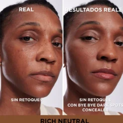Bye Bye Corrector Manchas Oscuras + Sérum