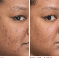 Bye Bye Dark Spots Serum Facial Minimizador Manchas Oscuras