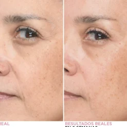 Bye Bye Lines Sérum Facial Reductor Líneas de Expresión