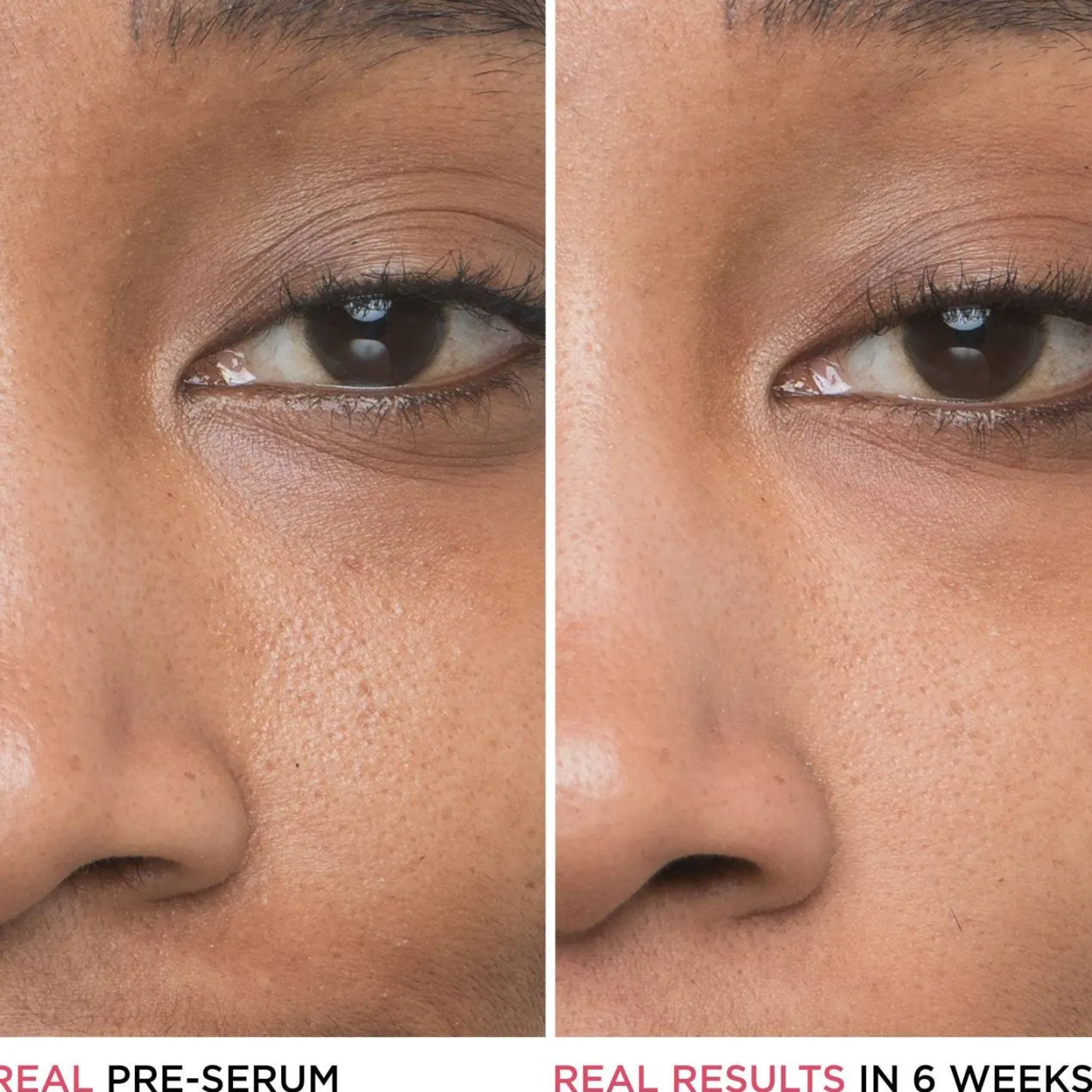 Bye Bye Pores Sérum Facial Minimizador de Poros