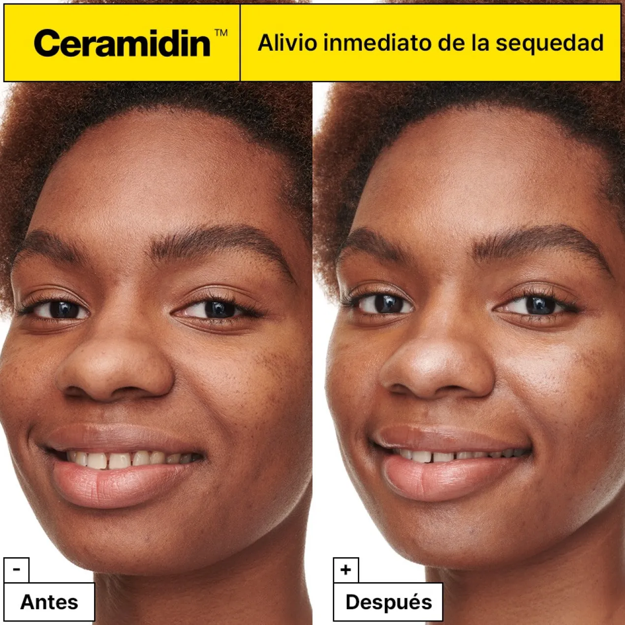 Ceramidin Crema Facial Hidratante