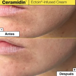 Ceramidin Crema Facial Hidratante con Ectoína