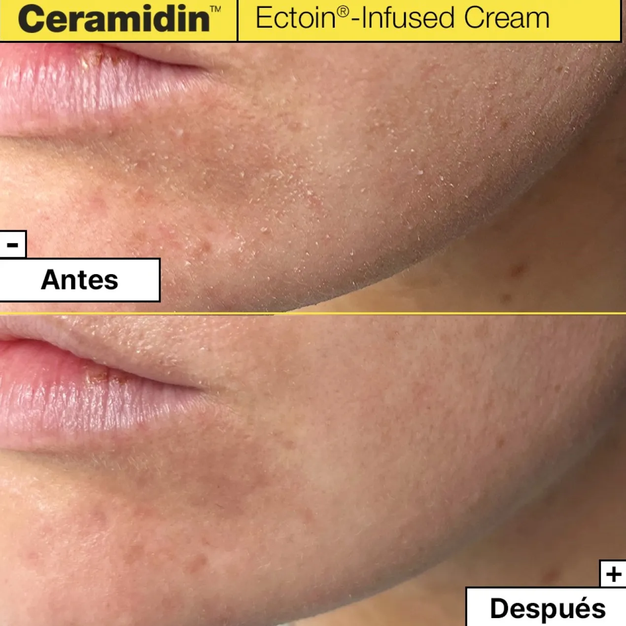 Ceramidin Crema Facial Hidratante con Ectoína