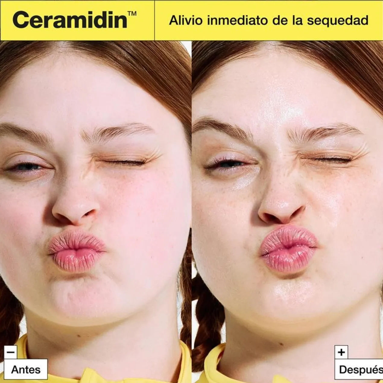 Ceramidin Crema Hidratante Skin Barrier Moisturizing