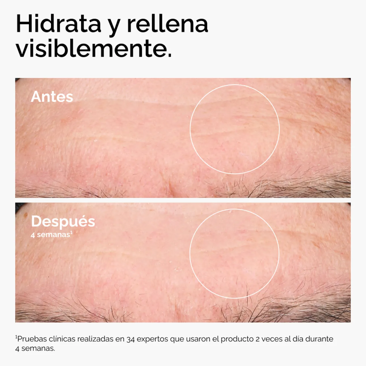 Ácido Hialurónico 2% + B5