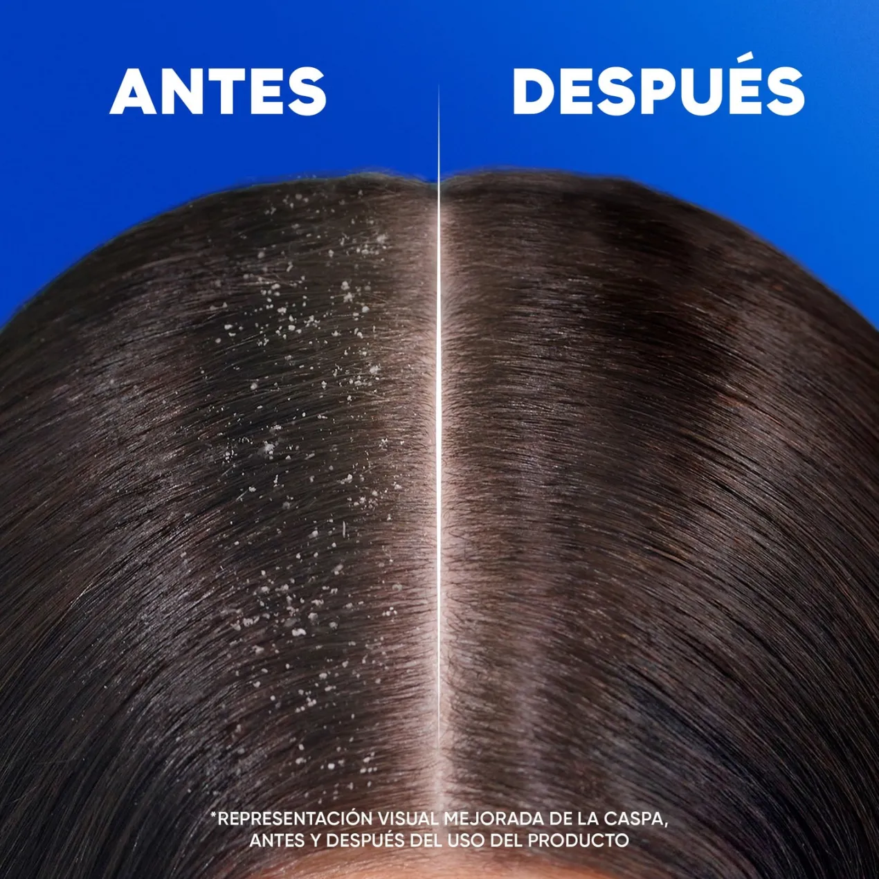 Classic Champú Anticaspa
