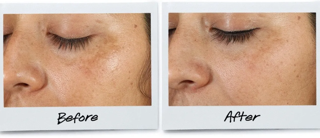 Clearly Corrective™ Dark Spot Solution Serum Facial Manchas