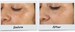Clearly Corrective™ Dark Spot Solution Serum Facial Manchas