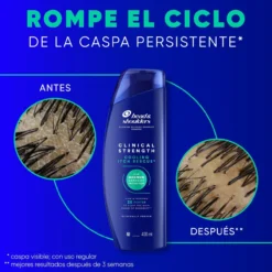 Clinical Strength Champú Alivio del Picor
