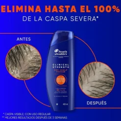 Clinical Strength Dry Scalp Rescue