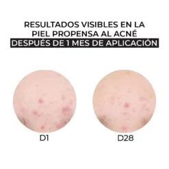 Crema Facial Hidratante para piel mixta y grasa
