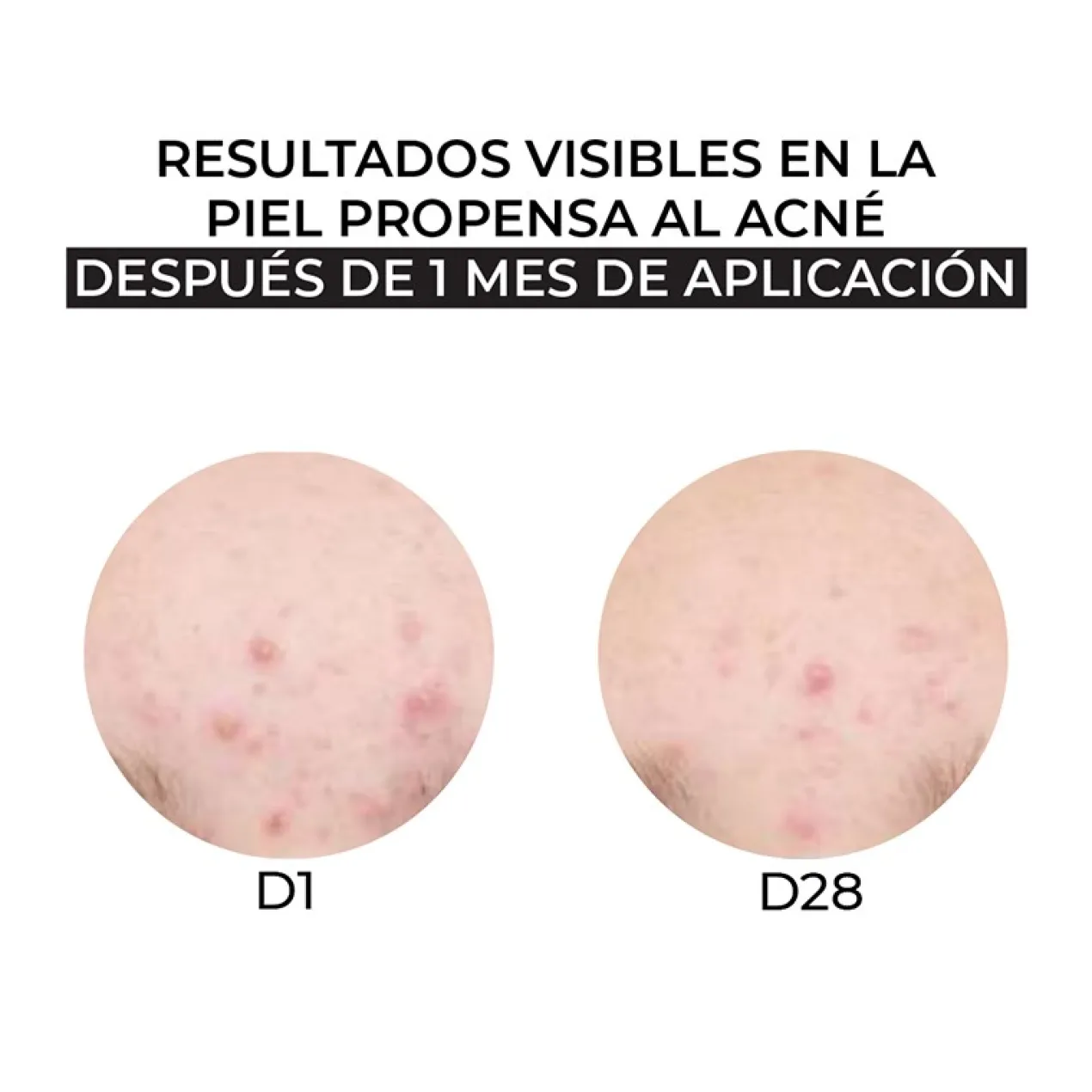 Crema Facial Hidratante para piel mixta y grasa