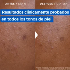 Crema Hidratante Antimanchas Niacidamide Bright