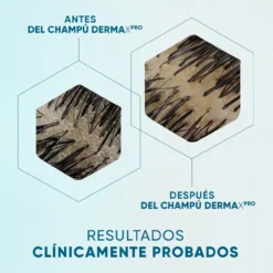 DermaXPro Champú Calmante Anticaspa