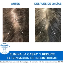 DS Hair Champú Anticaspa