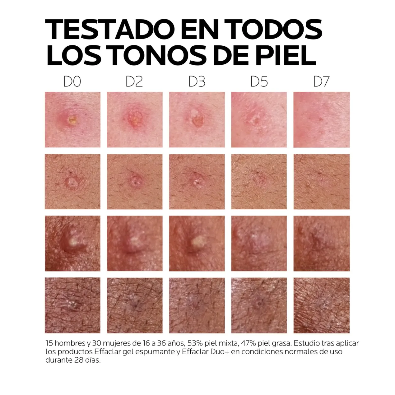 Effaclar Duo +M Tratamiento Corrector Facial Antiacné