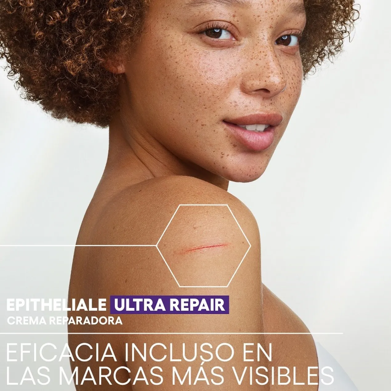 Epitheliale A.H Ultra Crema Reparadora Calmante Anti cicatrices