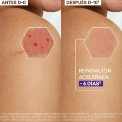 Epitheliale A.H Ultra Crema Reparadora Calmante Anti cicatrices