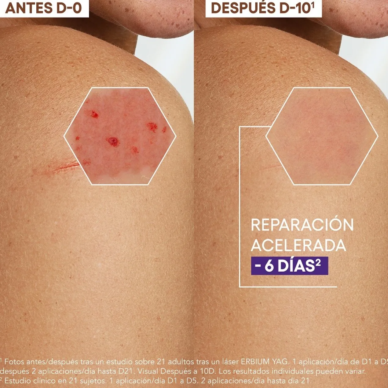 Epitheliale A.H Ultra Crema Reparadora Calmante Anti cicatrices