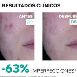 Hyséac 3-Regul+ Crema Cuidado Global
