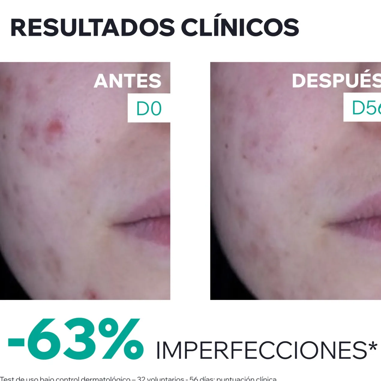 Hyséac 3-Regul+ Crema Cuidado Global