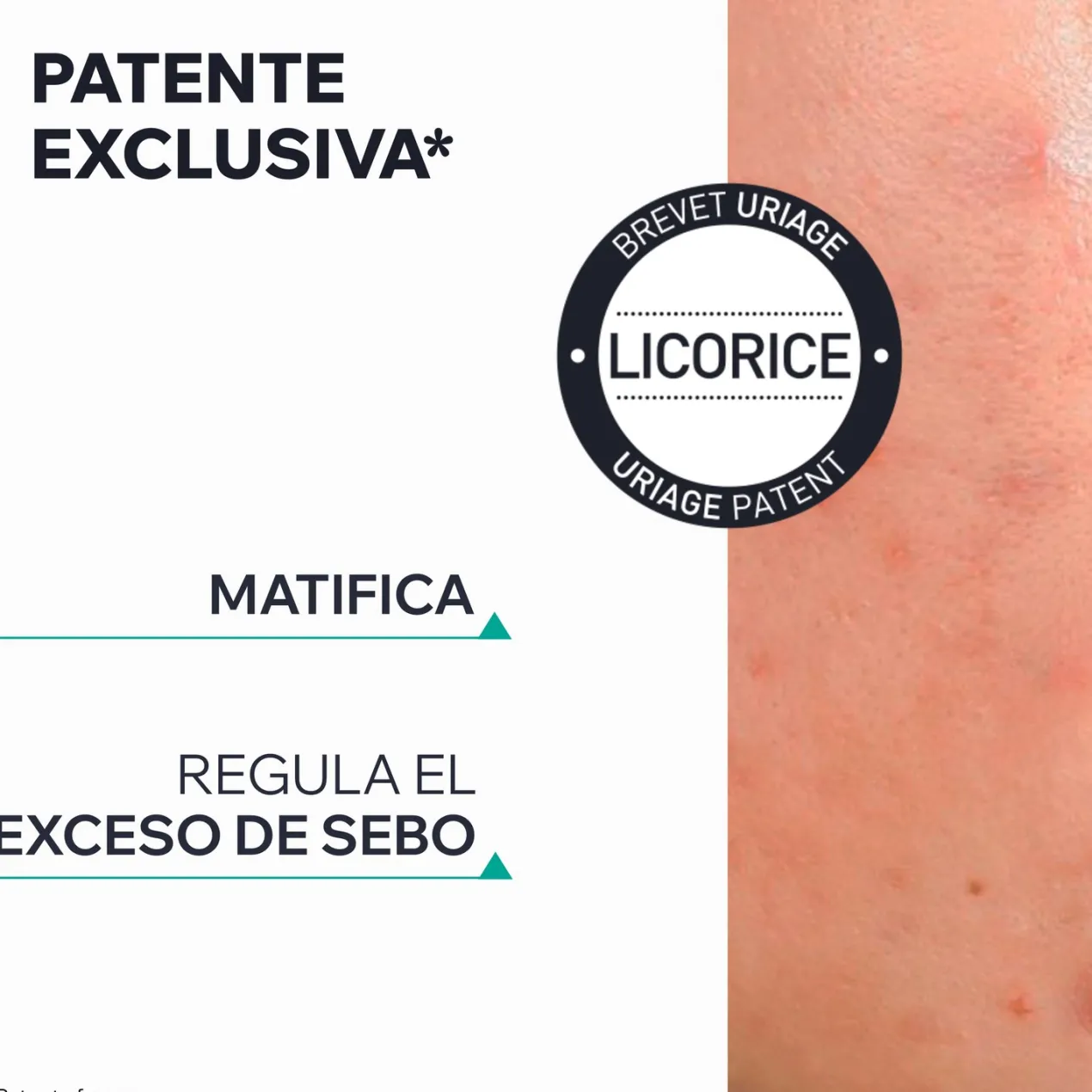 Hyséac 3-Regul+ Crema Cuidado Global