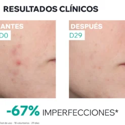 Hyseac Sérum Booster Anti-Imperfecciones
