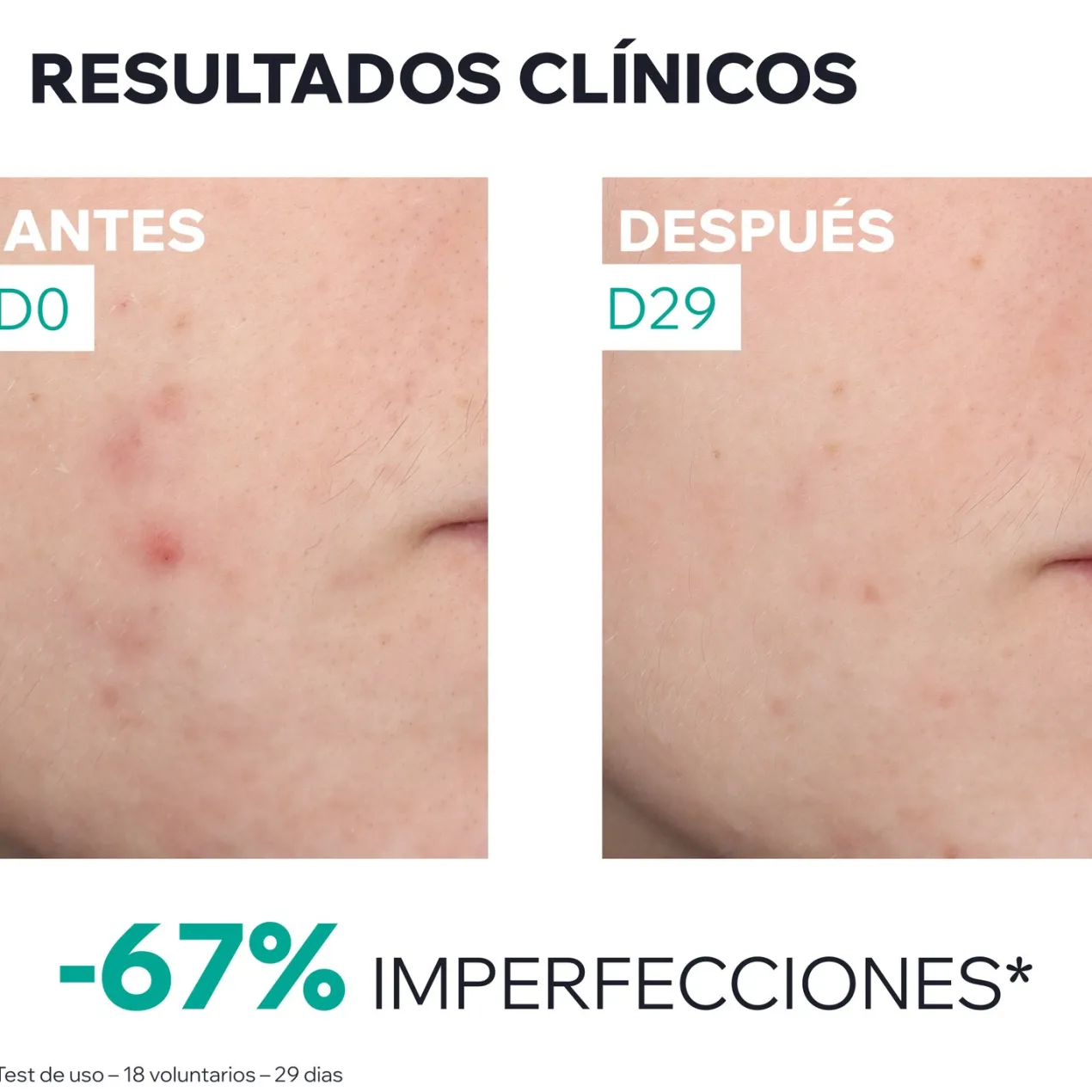 Hyseac Sérum Booster Anti-Imperfecciones