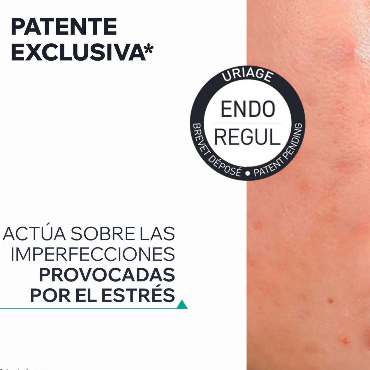Hyseac Sérum Booster Anti-Imperfecciones