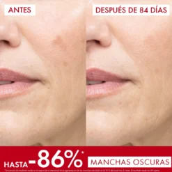 Liftactiv Pigment Specialist B3 Sérum Antimanchas