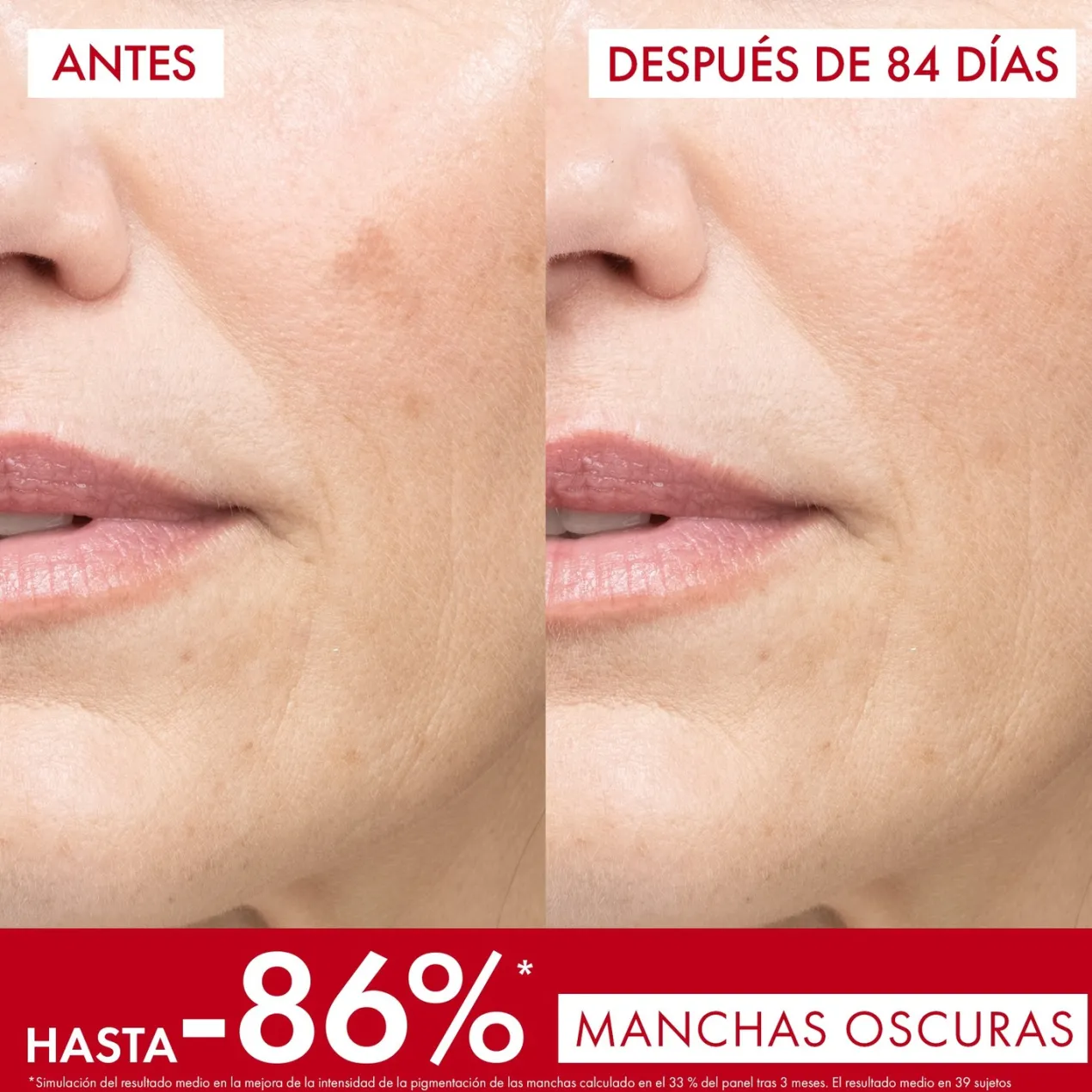 Liftactiv Pigment Specialist B3 Sérum Antimanchas