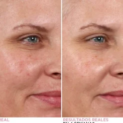Peeling Nocturno Hello Results Baby