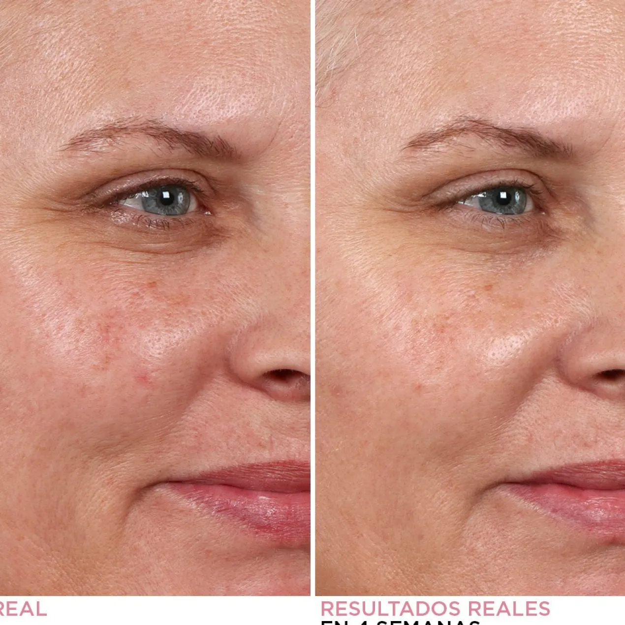 Peeling Nocturno Hello Results Baby