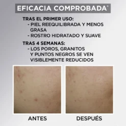 Pure Active Crema Hidratante Matificante con AHA + BHA con Carbón