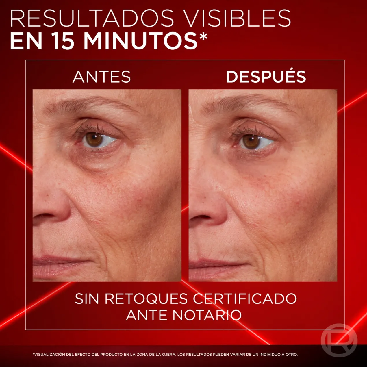 Revitalift Laser Borrador de Bolsas Instantáneo