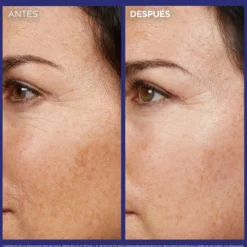 Revitalift Laser serum de noche retinol puro arrugas profundas