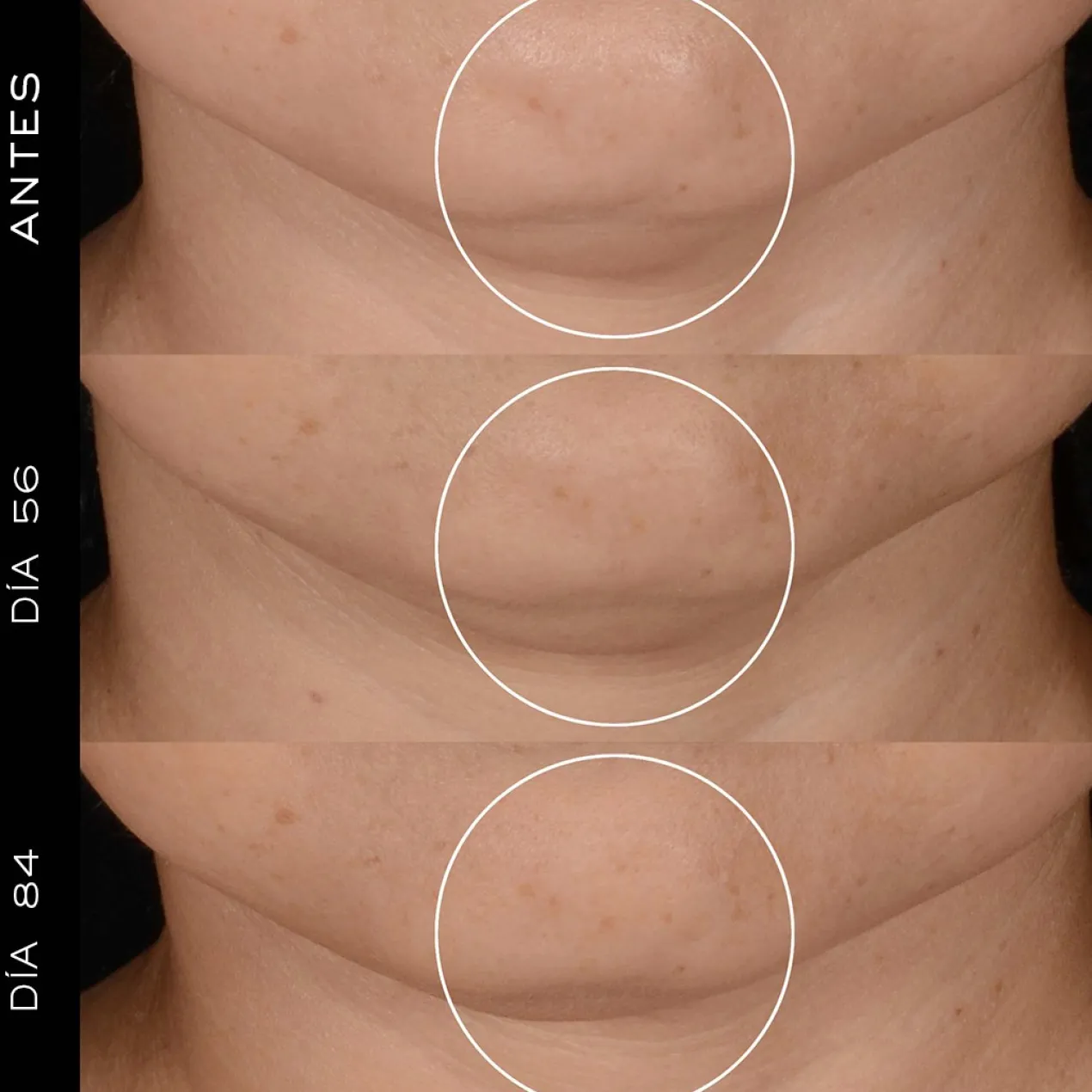 Rénergie H.P.N. 300 Peptide Cream