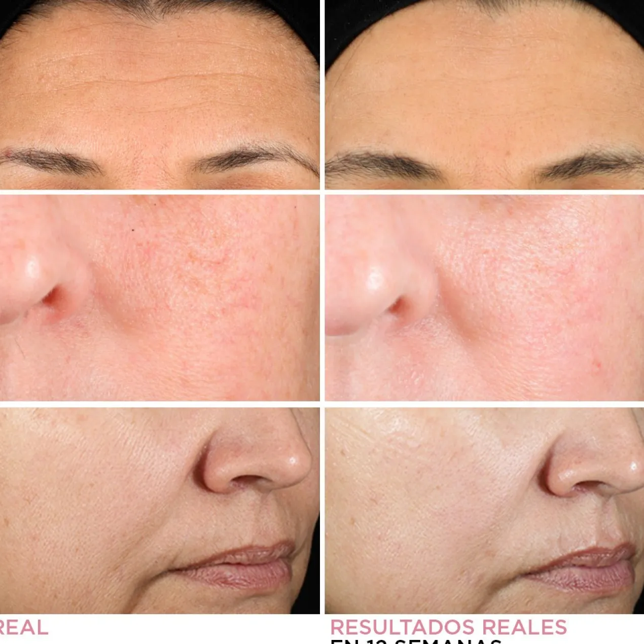 Serum en Crema con Retinol Hello Results