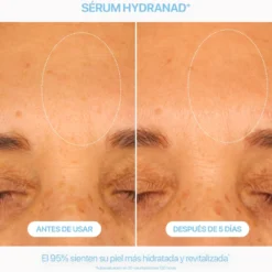Serum Hydranad+