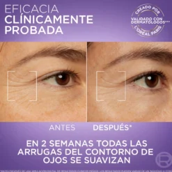 Serum Revitalift Filler 2,5 Ácido Hialurónico + Cafeína