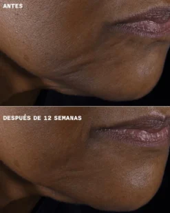 Smart Clinical Repair Crema Reafirmante + Lifting para Rostro y Cuello