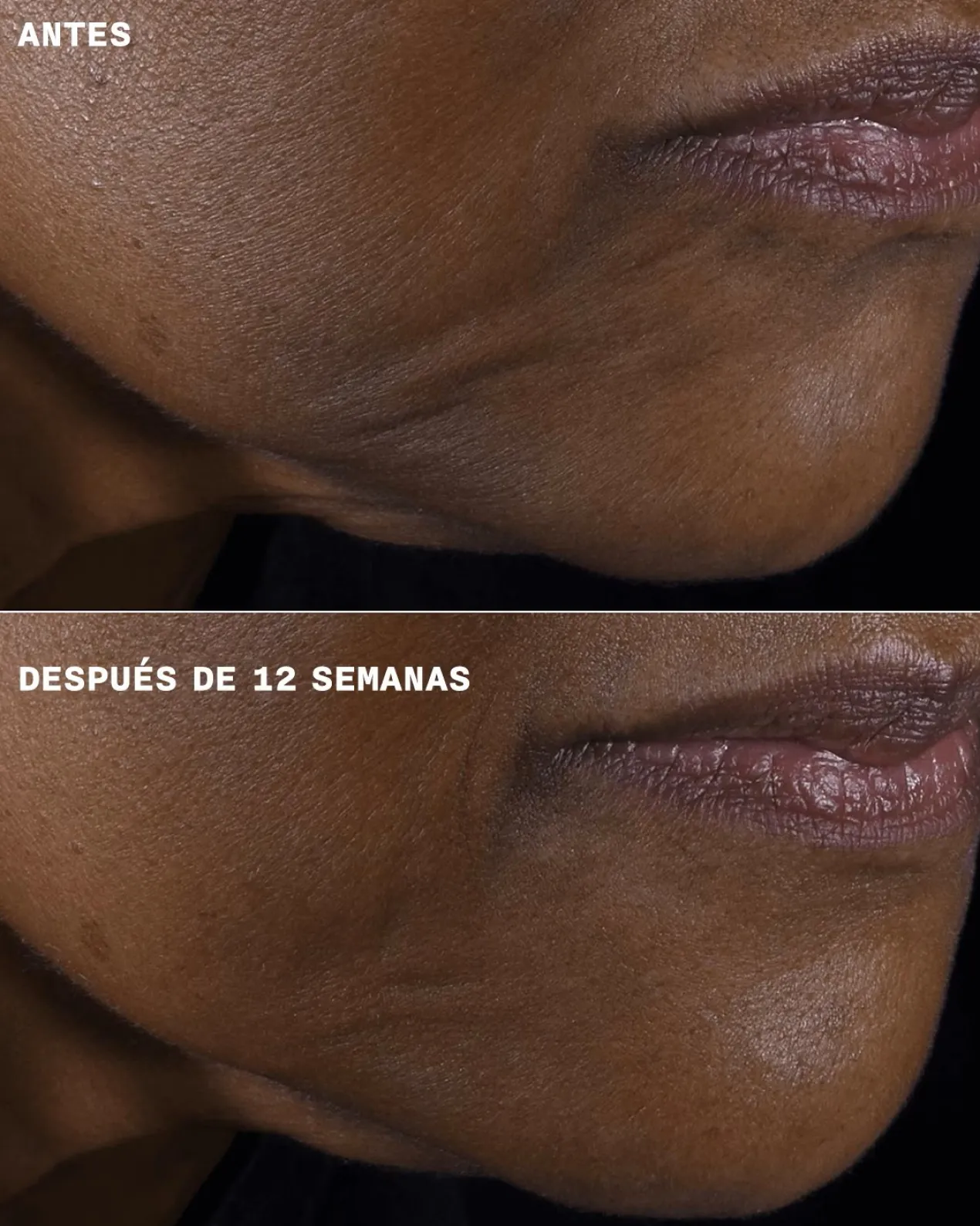 Smart Clinical Repair Crema Reafirmante + Lifting para Rostro y Cuello