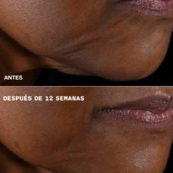 Smart Clinical Repair Crema Reafirmante + Lifting para Rostro y Cuello