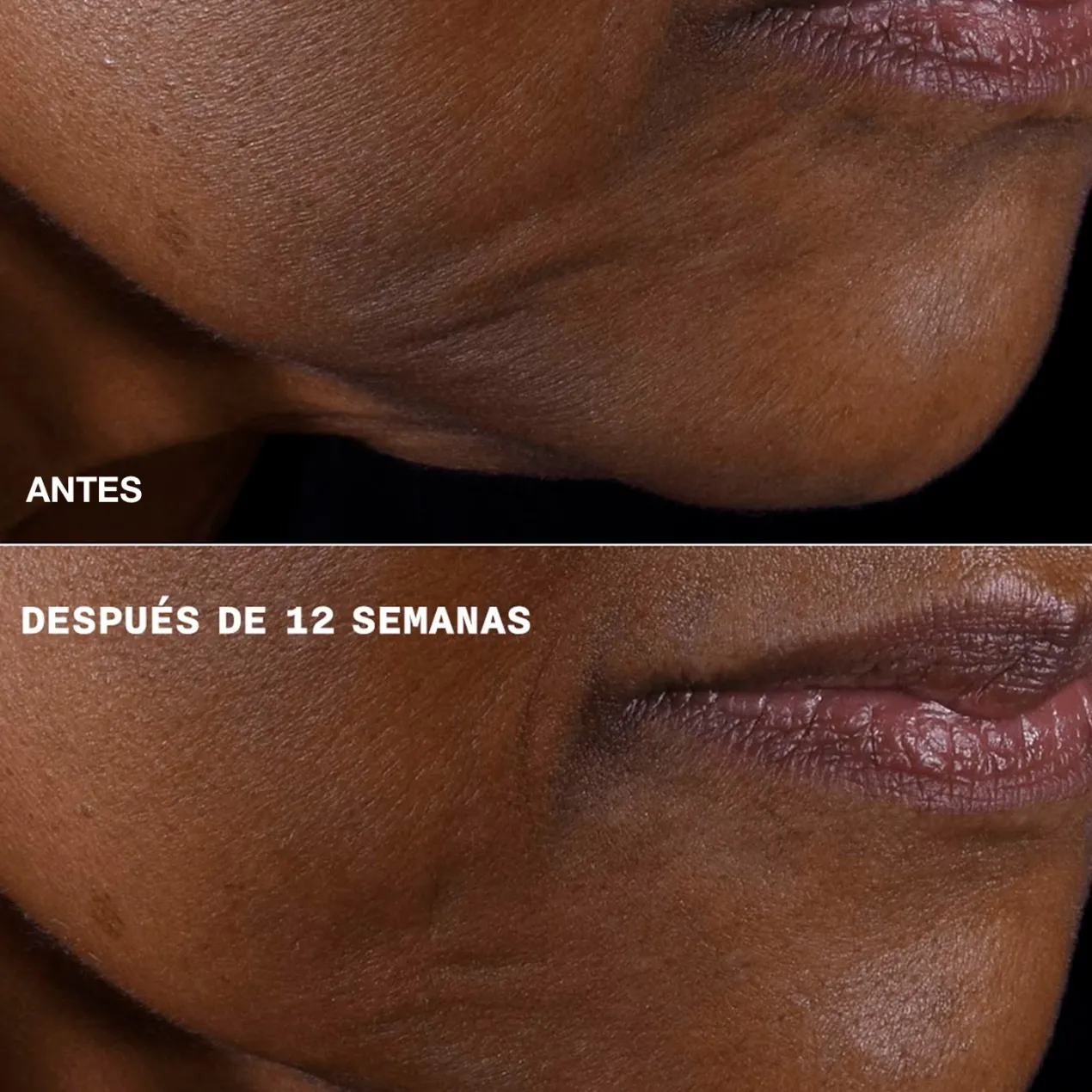 Smart Clinical Repair Crema Reafirmante + Lifting para Rostro y Cuello