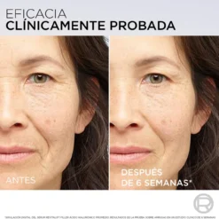 Sérum Revitalift Filler Hialurónico
