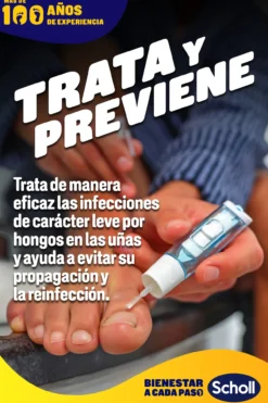 Tratamiento Anti Hongos de Uñas