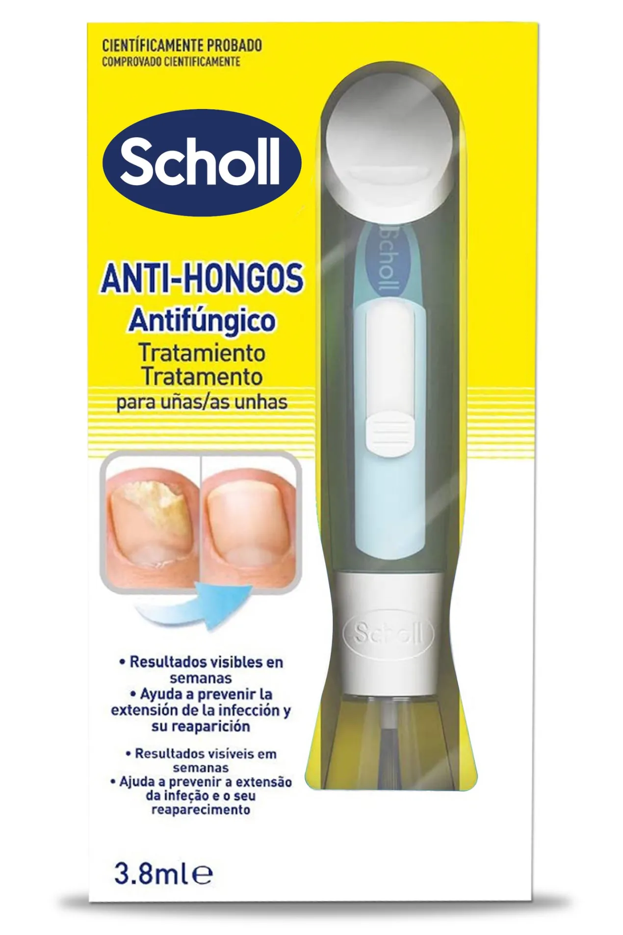 Tratamiento Anti Hongos de Uñas