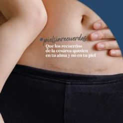 Tratamiento Reductor de Cicatrices