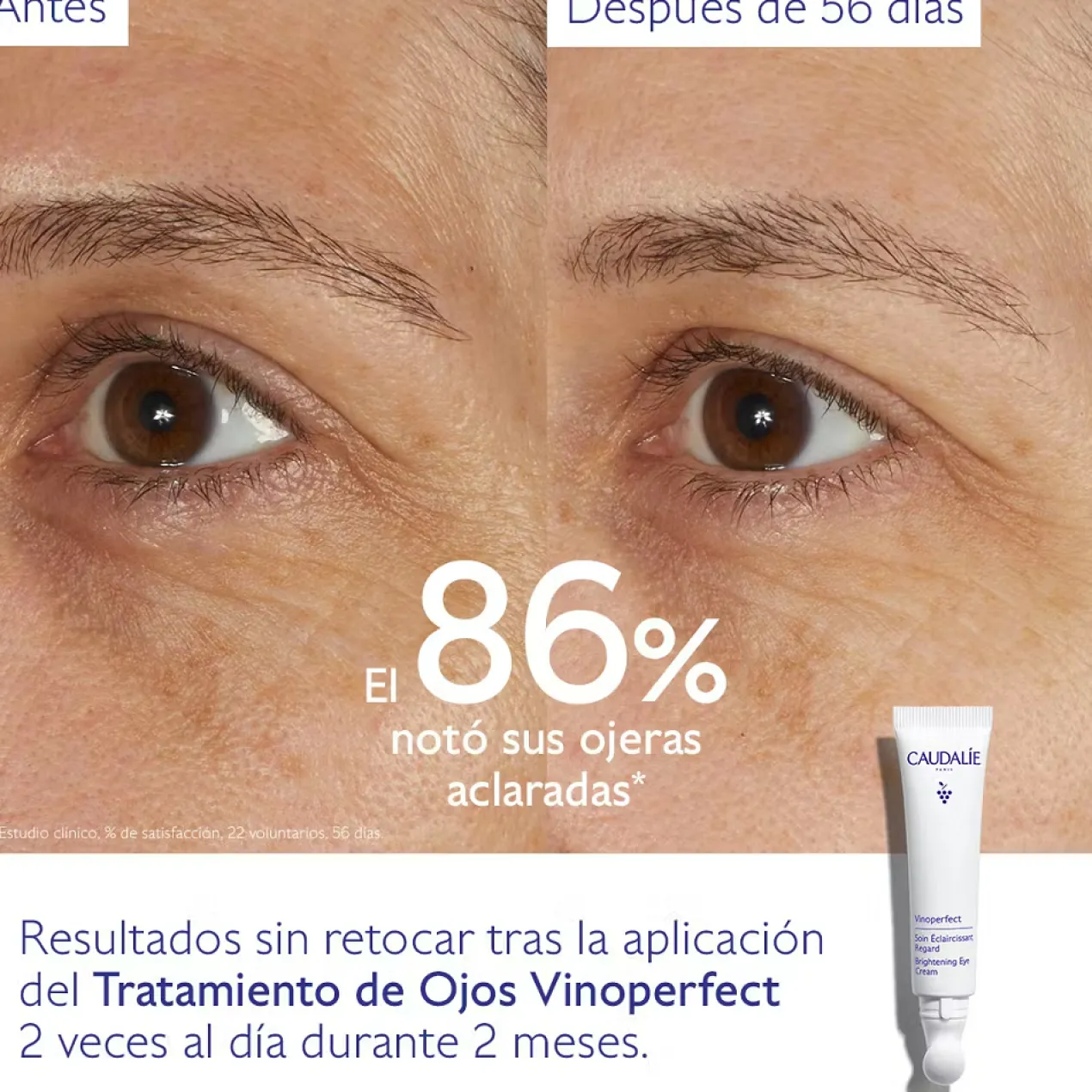 Vinoperfect Tratamiento de Ojos Iluminador